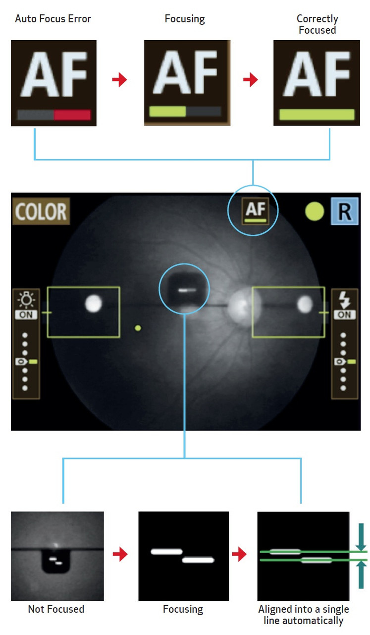 Canon CR-2 AF Non Mydriatic Retinal Camera Screenshots