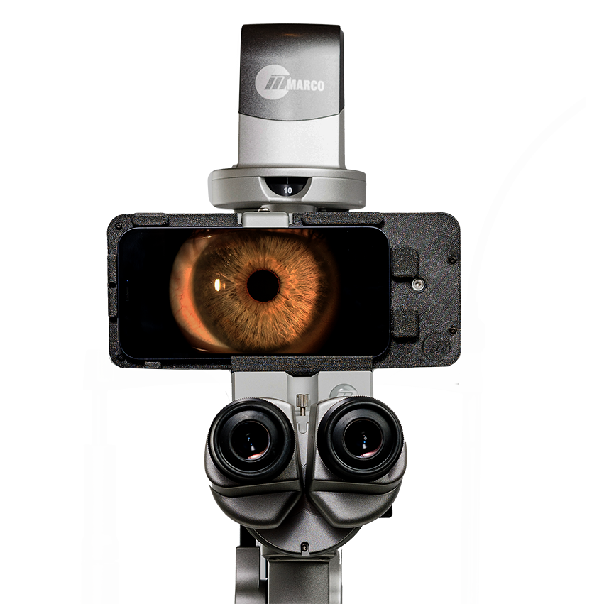Marco ION Imaging System Screen View