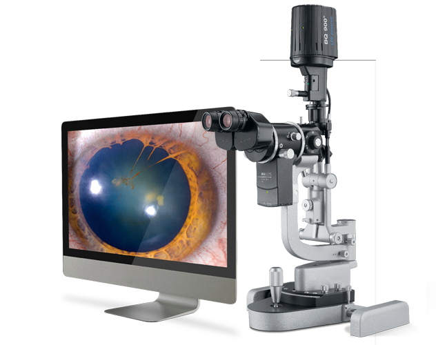 Haag-Streit IM 910 Imaging Module on Slit Lamp with Monitor